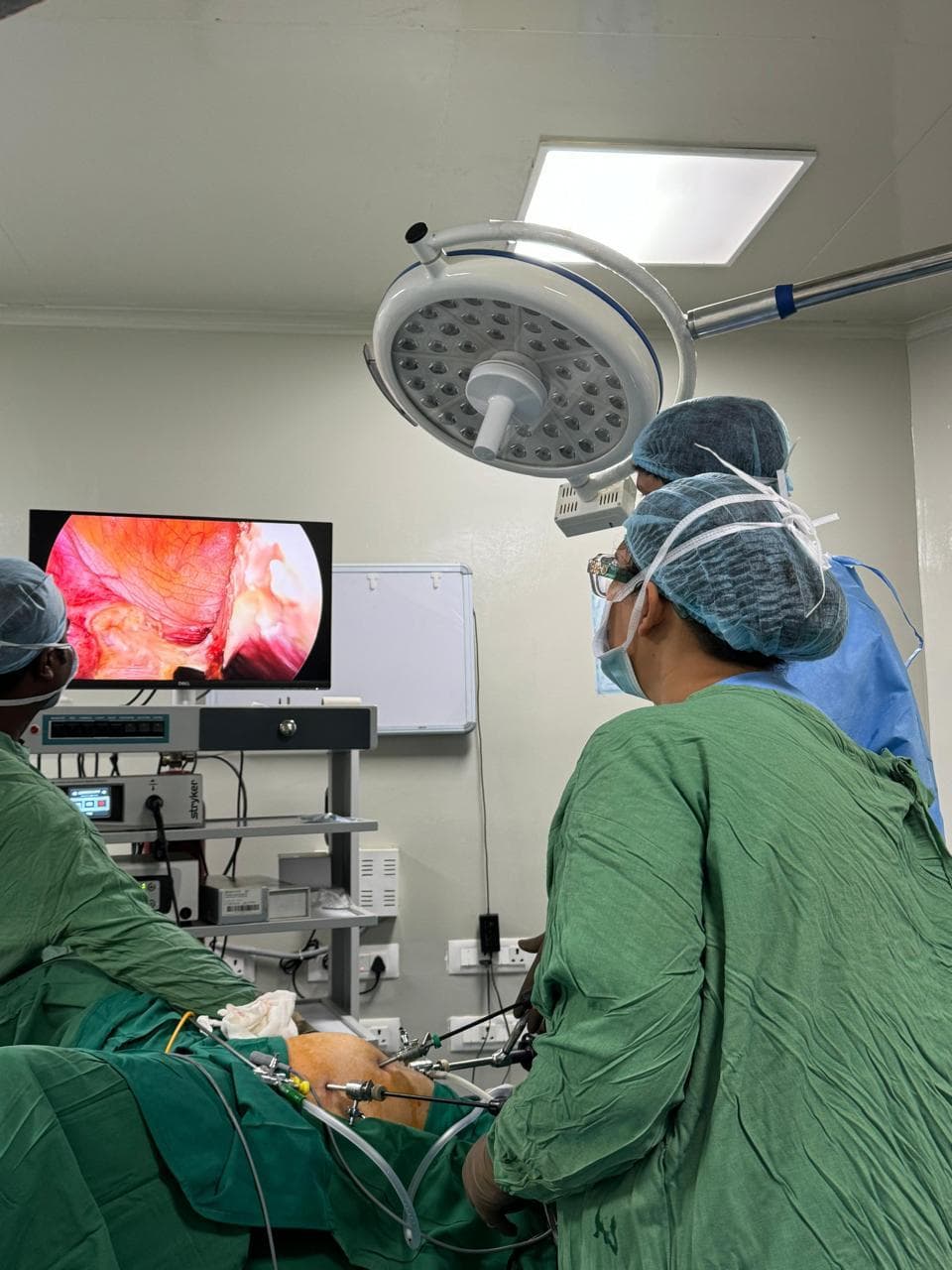 Laparoscopic surgery under way, the laparoscope view on the theatre monitor
